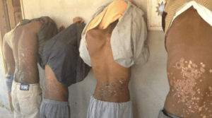People show signs of torture